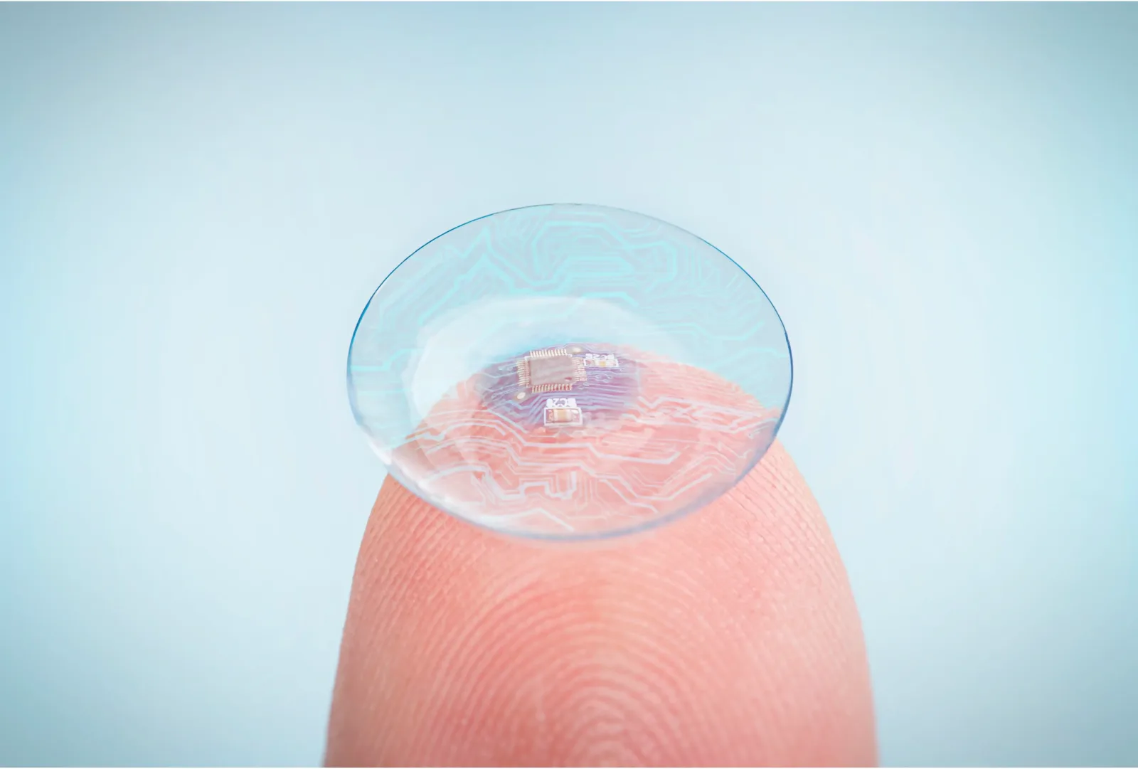 Smart Lens Replacement in Turkey