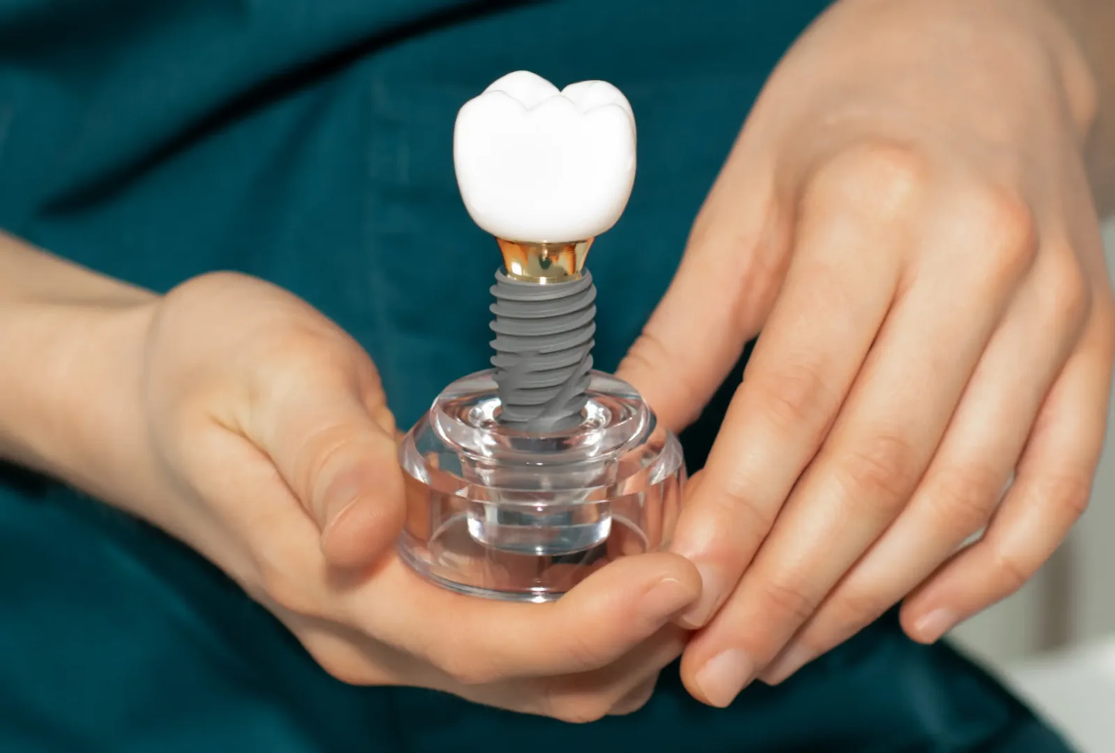 MedCarya Dental Implant Treatment Category in Antalya, Turkey