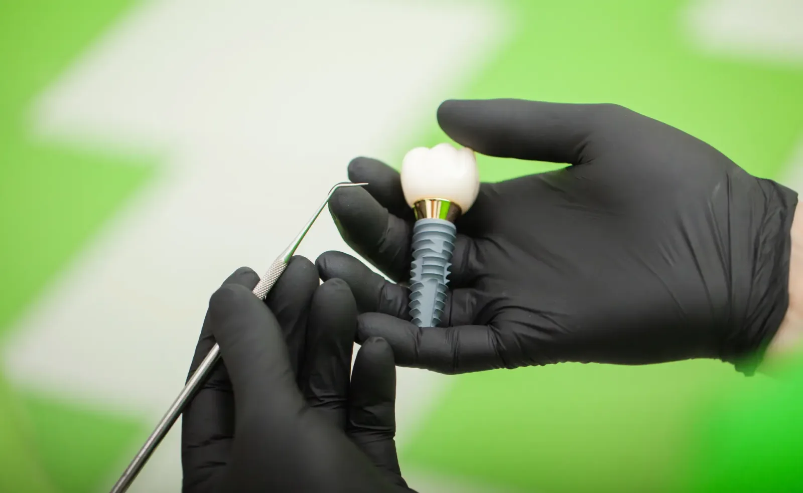 MedCarya All-on-6 Dental Implants Treatment in Antalya, Turkey