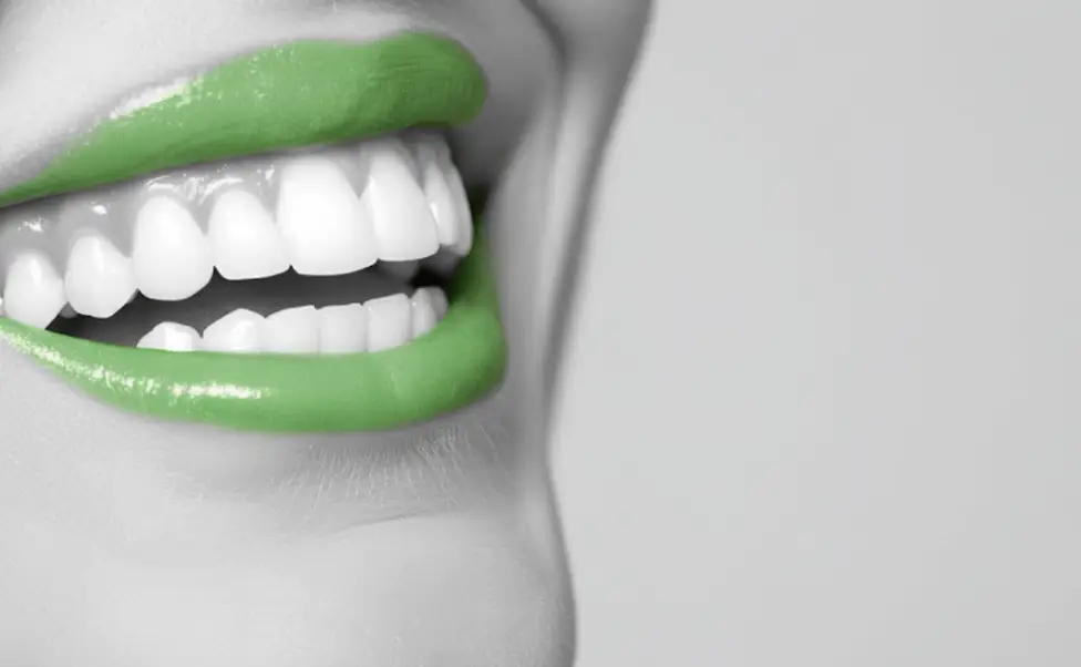 MedCarya Hollywood Smile Design Treatment in Antalya, Turkey